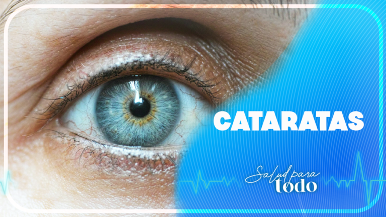 Cataratas en Salud para Todo